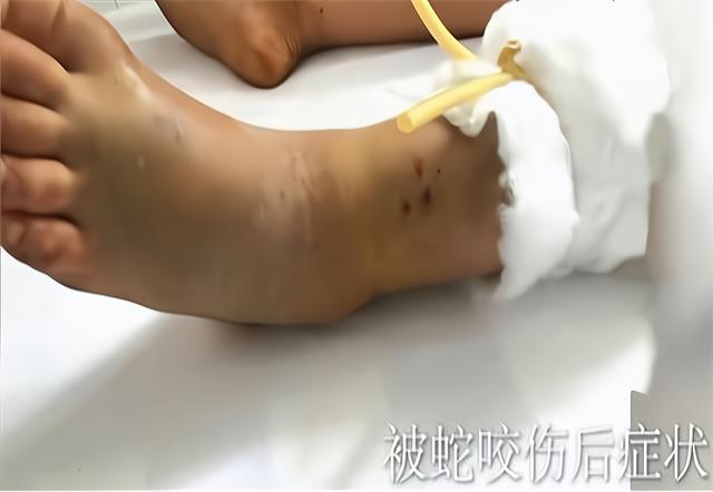 今晚澳门9点35分开奖实用性解读和女子遭毒蛇咬伤身亡与女子遭毒蛇咬伤身亡视频